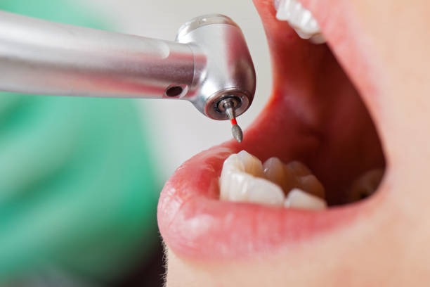Best Cracked Tooth Emergency Dentist  in Rupert, WV